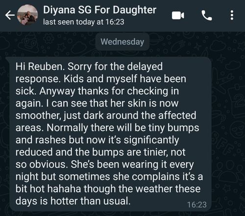 Customer photo review of Eczema Scratch Mitten
