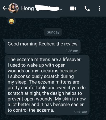 Customer photo review of Eczema Scratch Mitten