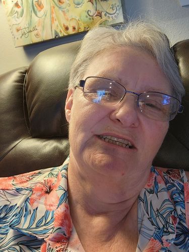 Customer photo review of Clear Retainer Partial Denture