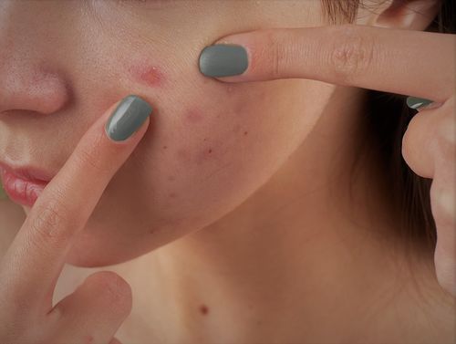 Customer photo review of Anti Aging Therapy: Age-Reverse & Beauty Products Frequencies