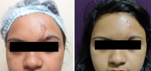 Customer photo review of Anti Aging Therapy: Age-Reverse & Beauty Products Frequencies