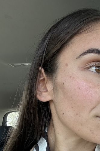 Customer photo review of Vitamin C serum
