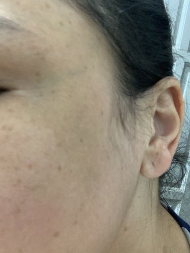 Customer photo review of Solução OXYresveratrol