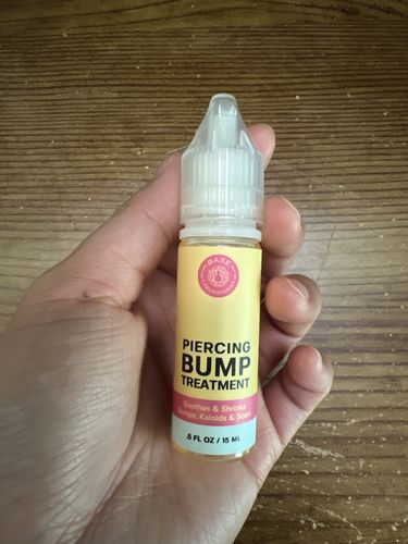 Customer photo review of Piercing Bump Treatment - Bump, Keloid & Scar Relief Oil