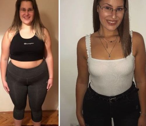 Customer photo review of Perfect Detox Slimming Patch(Limited Time Discount 🔥 Last Day)