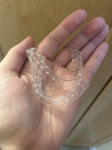 Customer photo review of Premium Upper and Lower Retainer Set