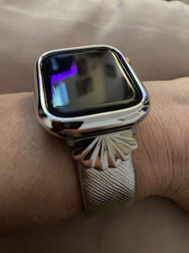 Customer photo review of Starburst Band for the Apple Watch