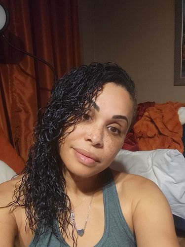 Customer photo review of SkinFix: Morpheus8
