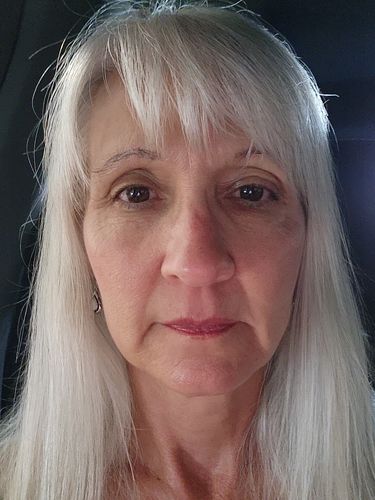 Customer photo review of EvenSkyn® Lumo: Premium Anti-Aging & Skin Tightening Handset