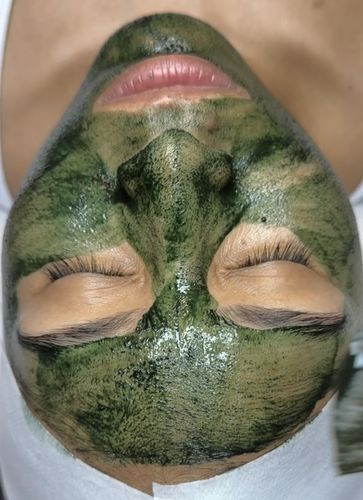 Customer photo review of KrX Green Sea Peel