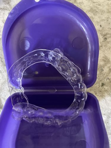 Customer photo review of Premium Upper and Lower Retainer Set