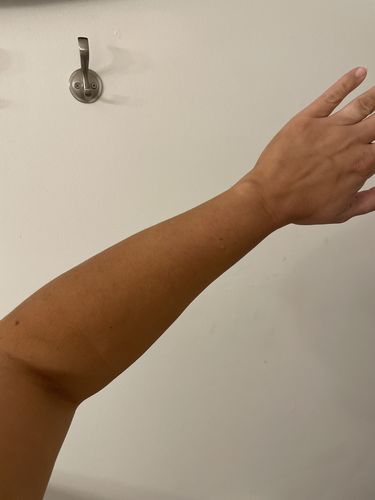 Customer photo review of Tanning Foam