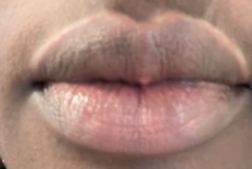 Customer photo review of Pink Lip Kit