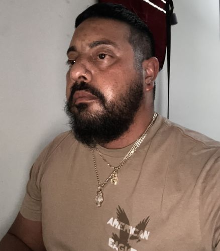 Customer photo review of 12.5% Minoxidil Extra Strength Topical Solution USP for Men.