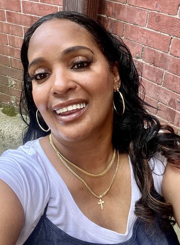 Customer photo review of JawlineFix: Filler