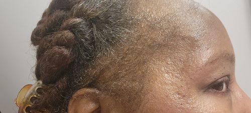 Effat P. review of India’s Secret Ancient Ayurvedic Hair Follicle Elixir (4 sizes) image 1 out of 1