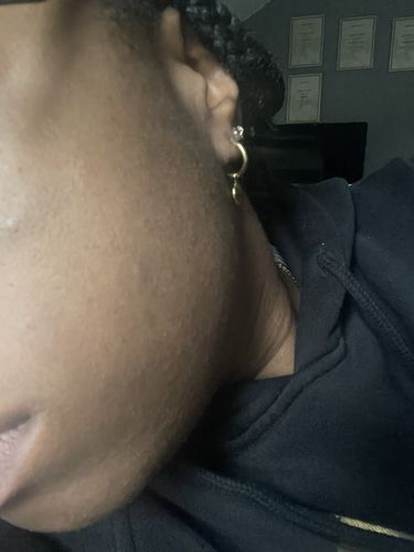 Customer photo review of GLOW DUOs