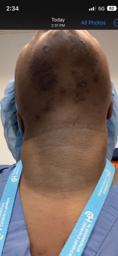 Customer photo review of BERRI-CLEAR+ 5 BERRY SUPERFRUIT SERUM