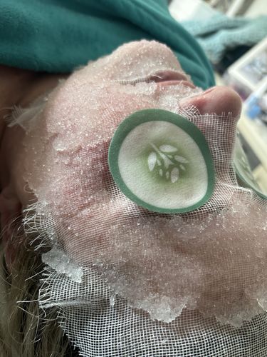 Customer photo review of KrX Cryofacial Caps