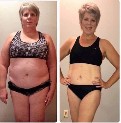 Customer photo review of Perfecte™ Herbs Detox Slimming Patch(Limited Time Discount 🔥 Last Day)