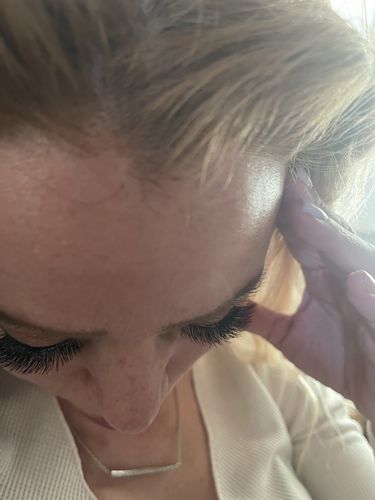 Customer photo review of EvenSkyn® Lumo: Premium Anti-Aging & Skin Tightening Handset