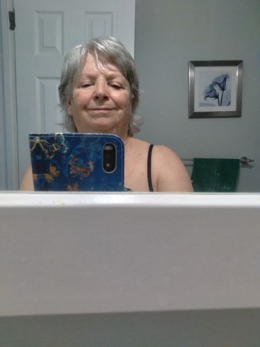 Customer photo review of EvenSkyn® Lumo: Premium Anti-Aging & Skin Tightening Handset