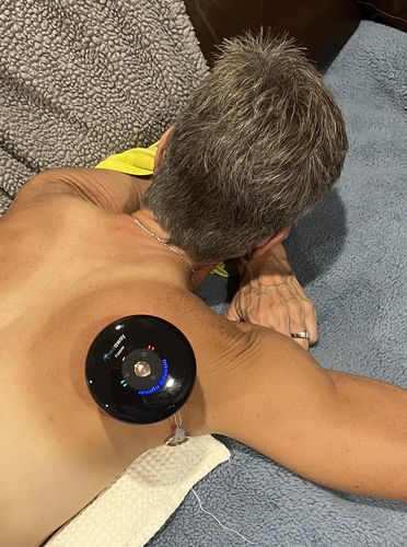 Customer photo review of Achedaway Cupper - The Smart Cupping Therapy Massager
