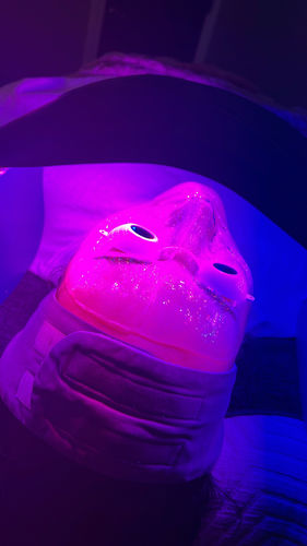 Customer photo review of The CryoPeptide 20 Pack