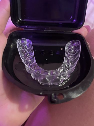 Customer photo review of Upper Teeth Retainer