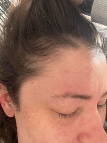 Customer photo review of Scalp Care - 10 Minute Miracle - Mega Bundle