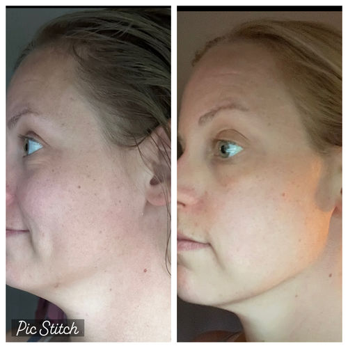 Customer photo review of Anti-Aging Cloud Cream