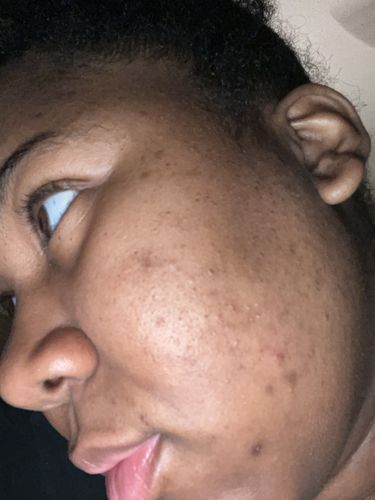 Customer photo review of DUO bundle