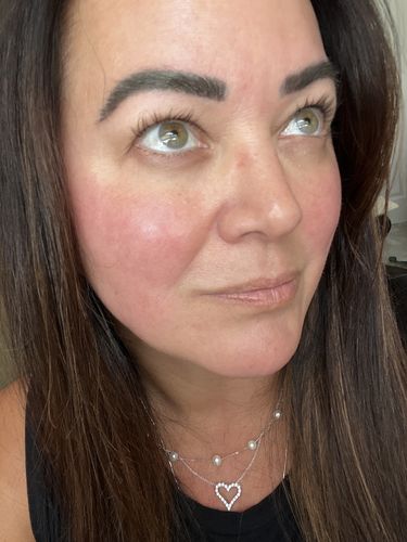 Customer photo review of ETERNAL EYELASH GROWTH SOLUTION