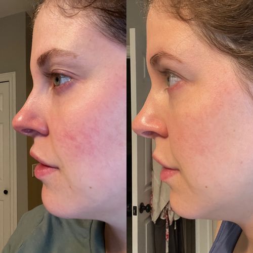 Customer photo review of Anti-Aging Cloud Cream