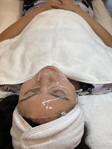 Customer photo review of The CryoPeptide 20 Pack