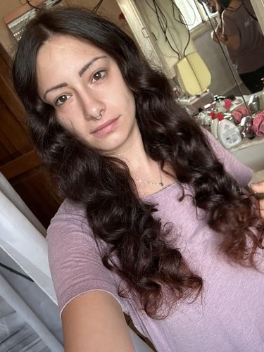 Customer photo review of Bigoodino® - Scalp