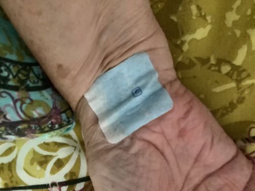 Customer photo review of Sleep Patches