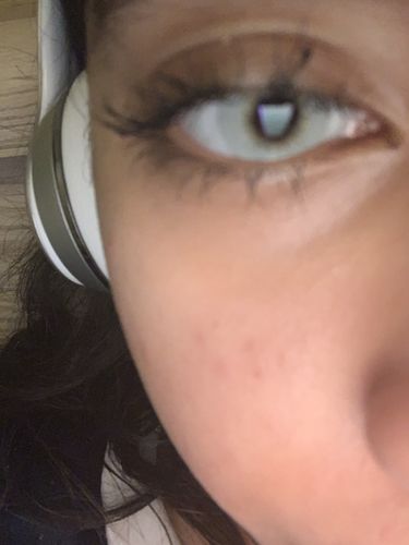 Customer photo review of LA Girl Grey Contact Lenses(12 months of use)