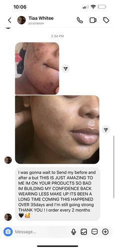 Customer photo review of LIMITED EDITION KIT Jolie’s Mini Full Body & Face Brightening Kit