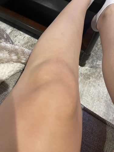 Customer photo review of Dark Spot Brightening Cream