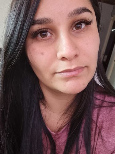 Customer photo review of Glycolic Acid 7% Exfoliating Toning Solution 240ml