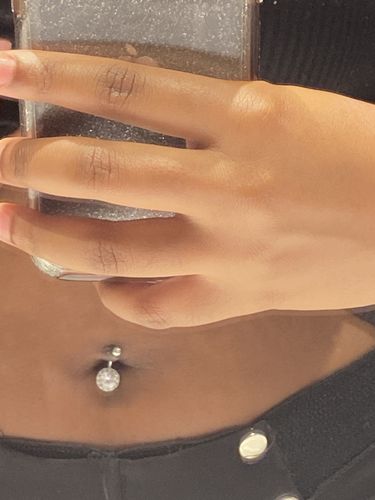 Customer photo review of Piercing Bump Treatment - Bump, Keloid & Scar Relief Oil