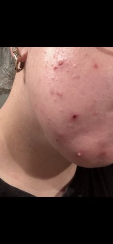 Customer photo review of Intermediate Reset Program