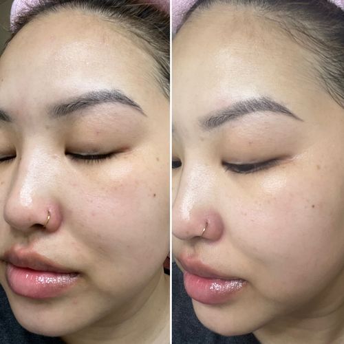 Customer photo review of KrX Cica Recovery Bundle