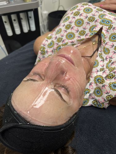 Customer photo review of The CryoPeptide 20 Pack