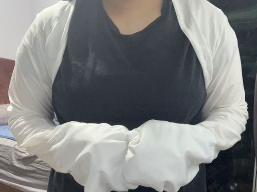 Customer photo review of Eczema Scratch Mitten