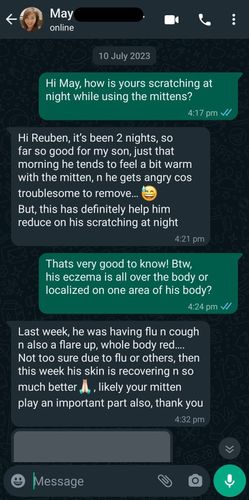 Customer photo review of Eczema Scratch Mitten