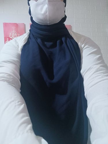 Customer photo review of Eczema Scratch Mitten