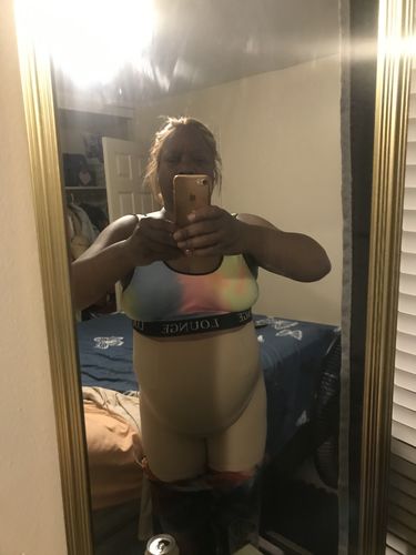 Customer photo review of NatruLift "Summer Time Fine" Package