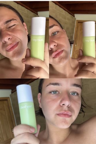 Customer photo review of Gel Moisturiser